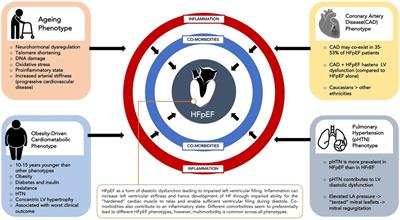 Inflammation as a therapeutic target in heart failure with preserved ejection fraction